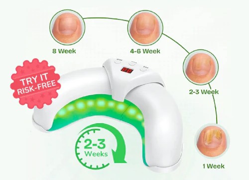 NeoCure™ Nail Healing Device