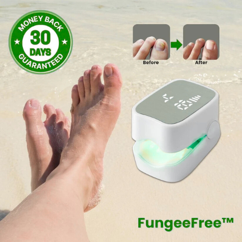 RILO™ - Nail Fungus Laser