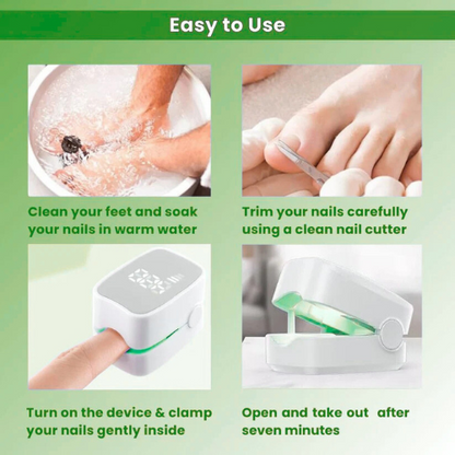RILO™ - Nail Fungus Laser